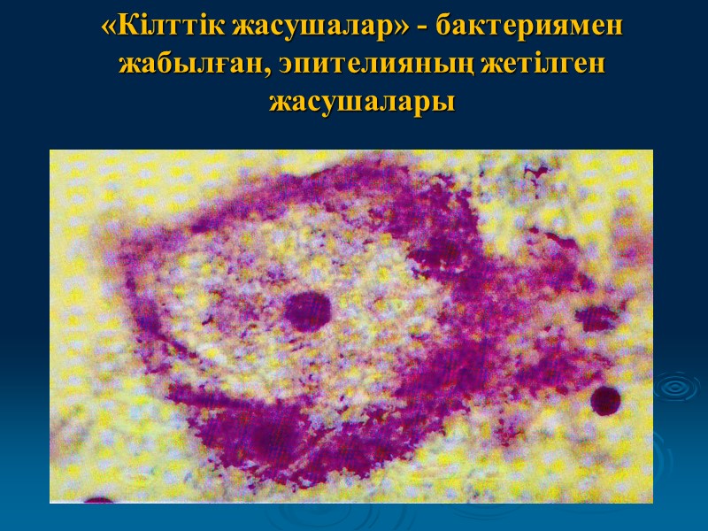 «Кілттік жасушалар» - бактериямен жабылған, эпителияның жетілген жасушалары